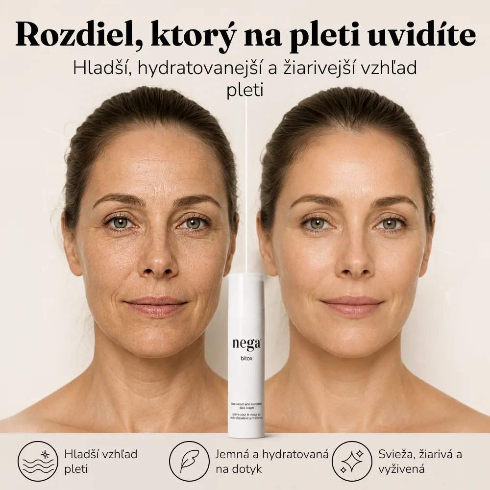 Bitox, krém s včelím jedom - Image 6
